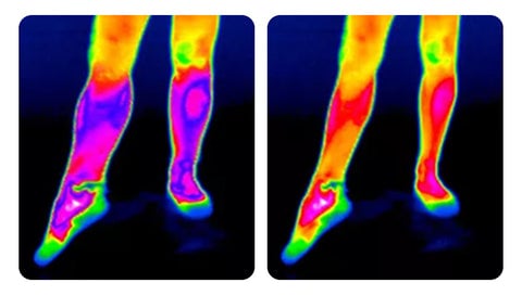 Self-heating knee brace: fast pain relief