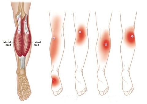 Self-heating knee brace: fast pain relief