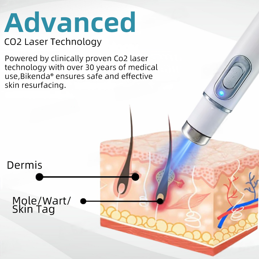 Non-Invasive Mole and Wart Removal Laser Pen Promax