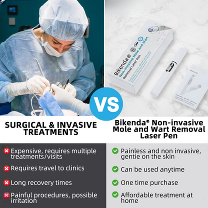 Non-Invasive Mole and Wart Removal Laser Pen Promax