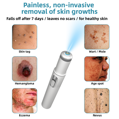 Non-Invasive Mole and Wart Removal Laser Pen Promax